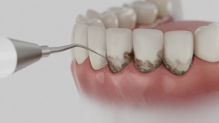 Reliable Dental Implants contractor in West Ishpeming, MI by Smile Center Dentistry